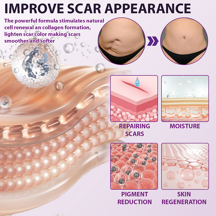 BQYOOM™ SiluSkin Advanced Face & Body Scar Gel🎉SPECIAL OFFER: 60% OFF This Today Only!🔥