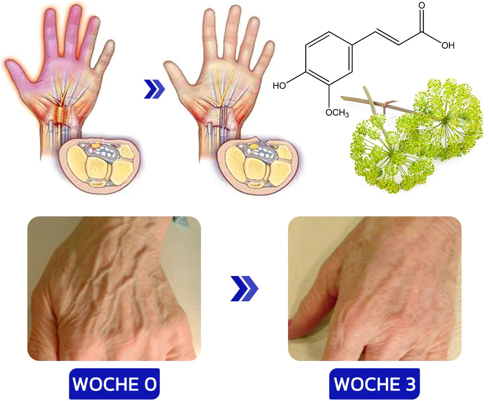 🎁 Sale 48% - GFOUK™ NumbFix Hand and Foot Spray