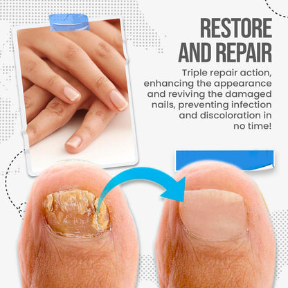 🛡️🛡️South Moon Nail Treatment Cream