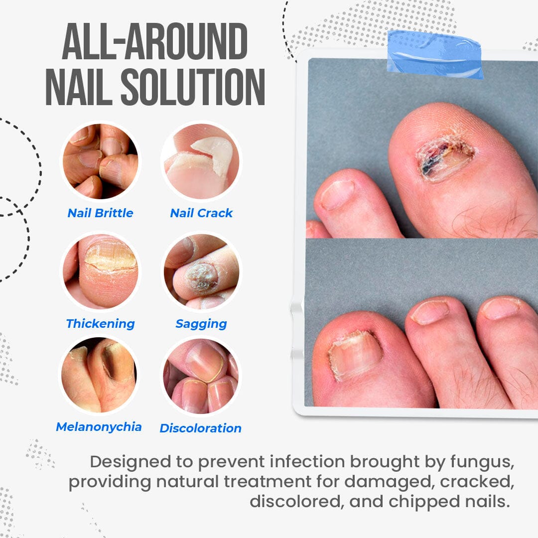 🛡️🛡️South Moon Nail Treatment Cream