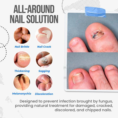 🛡️🛡️South Moon Nail Treatment Cream