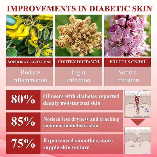 ⏰Last Day Promotion: 70% OFF 🔥BQYOOM™ GlucoseGuard Skin Rescue Cream