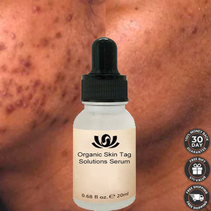 Organic Skin Spot Pigmentation Remover