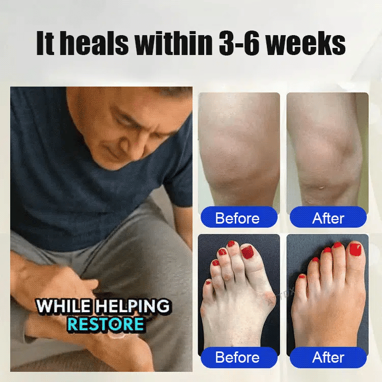 ⏳Limited-time 49% off⏰💥Czticle® Foot nerve care cream