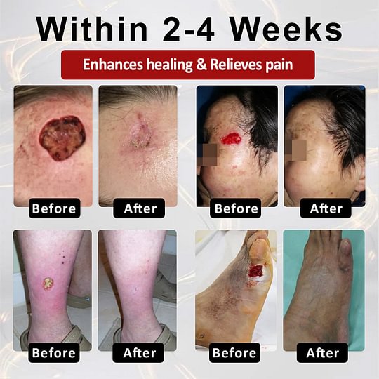 ⏰Last Day Promotion: 70% OFF 🔥BQYOOM™ GlucoseGuard Skin Rescue Cream