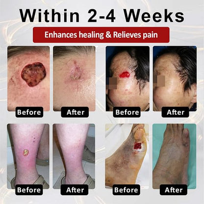 ⏰Last Day Promotion: 70% OFF 🔥BQYOOM™ GlucoseGuard Skin Rescue Cream