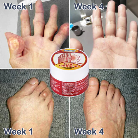 Biancat™ New Zealand Bee Venom Professional Care Gel