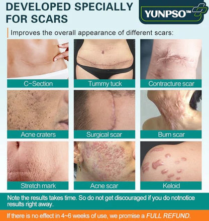 ❤️YUNPSO™ Advanced Scar Spray For All Types of Scars - For example Acne Scars, Surgical Scars and Stretch Marks