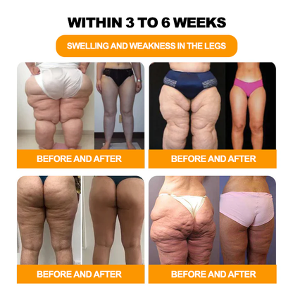 𝐀𝐧𝐧𝐢𝐞𝐂𝐚𝐫𝐞® 𝟑𝟎-𝐇𝐞𝐫𝐛 𝐒𝐥𝐢𝐦𝐦𝐢𝐧𝐠 & 𝐃𝐞𝐭𝐨𝐱 𝐅𝐨𝐨𝐭 𝐁𝐚𝐭𝐡 𝐁𝐞𝐚𝐝𝐬👩‍⚕️