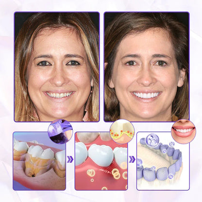 BeeRenew Advanced Gum Healing Toothpaste🎉SPECIAL OFFER: 60% OFF This Today Only!🔥