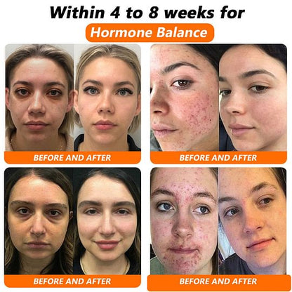 🎉Bee Venom NMN Natural Repair Vaginal Capsules👩‍❤️‍👩【Regulates hormone imbalance, obesity, acne, uterine fibroids and vaginal diseases】👩‍❤️‍👩