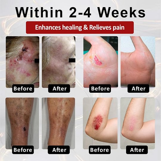 ⏰Last Day Promotion: 70% OFF 🔥BQYOOM™ GlucoseGuard Skin Rescue Cream