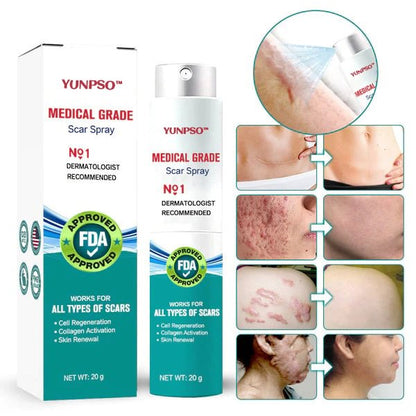 ❤️YUNPSO™ Advanced Scar Spray For All Types of Scars - For example Acne Scars, Surgical Scars and Stretch Marks