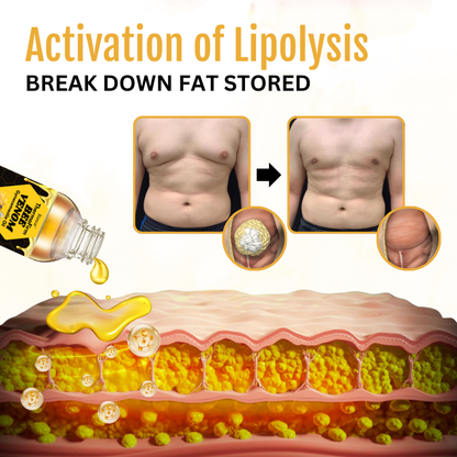 Biancat® ThermoFirm Bee Venom Gynecomastia Oil🎉SPECIAL OFFER: 60% OFF This Today Only!🔥