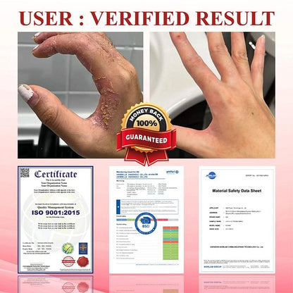 ⏰Last Day Promotion: 70% OFF 🔥BQYOOM™ GlucoseGuard Skin Rescue Cream