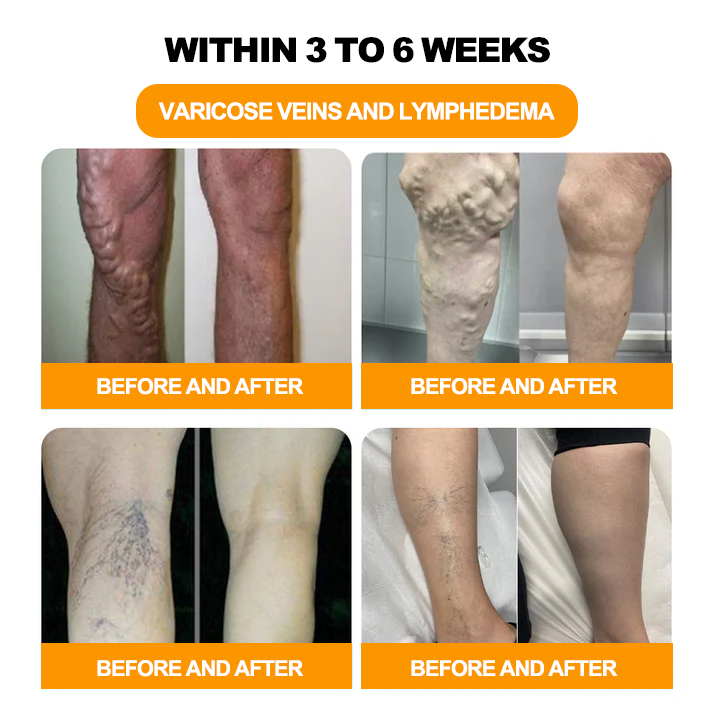 𝐀𝐧𝐧𝐢𝐞𝐂𝐚𝐫𝐞® 𝟑𝟎-𝐇𝐞𝐫𝐛 𝐒𝐥𝐢𝐦𝐦𝐢𝐧𝐠 & 𝐃𝐞𝐭𝐨𝐱 𝐅𝐨𝐨𝐭 𝐁𝐚𝐭𝐡 𝐁𝐞𝐚𝐝𝐬👩‍⚕️