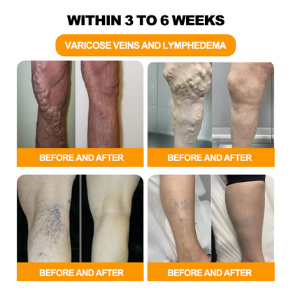 𝐀𝐧𝐧𝐢𝐞𝐂𝐚𝐫𝐞® 𝟑𝟎-𝐇𝐞𝐫𝐛 𝐒𝐥𝐢𝐦𝐦𝐢𝐧𝐠 & 𝐃𝐞𝐭𝐨𝐱 𝐅𝐨𝐨𝐭 𝐁𝐚𝐭𝐡 𝐁𝐞𝐚𝐝𝐬👩‍⚕️