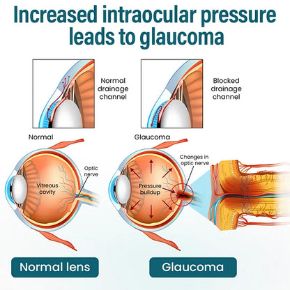 YUNPSO™ VisioRenew Nano Eye Serum🔥The FDA-Approved Solution🌟 Official Store |🔥Hot Sale - 49% OFF🌿