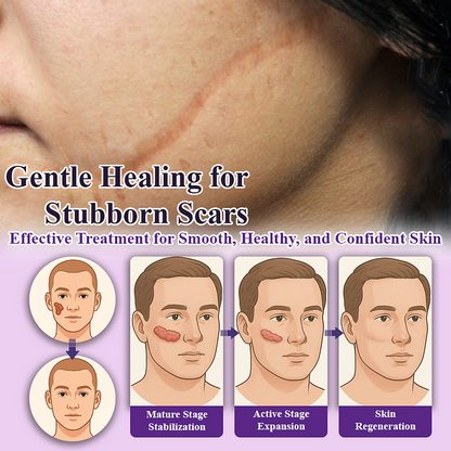 BQYOOM™ SiluSkin Advanced Face & Body Scar Gel🎉SPECIAL OFFER: 60% OFF This Today Only!🔥