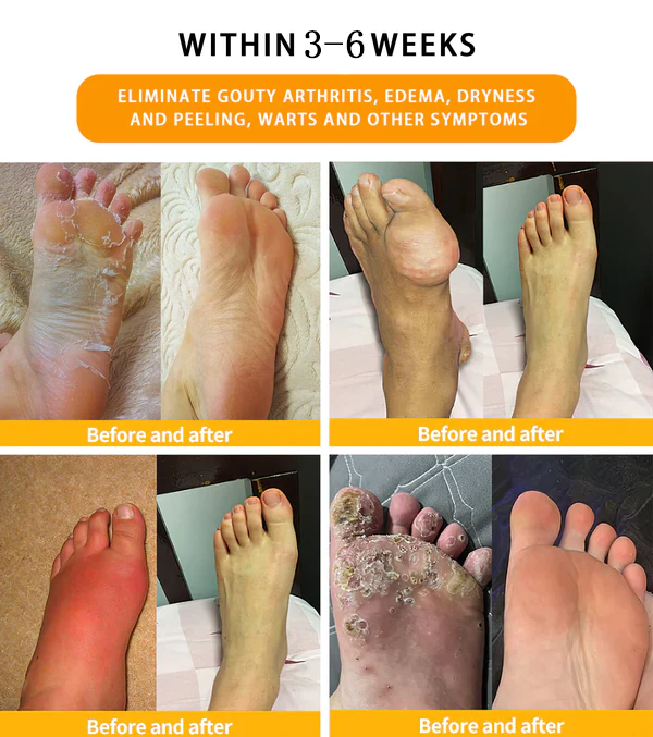 𝐀𝐧𝐧𝐢𝐞𝐂𝐚𝐫𝐞® 𝟑𝟎-𝐇𝐞𝐫𝐛 𝐒𝐥𝐢𝐦𝐦𝐢𝐧𝐠 & 𝐃𝐞𝐭𝐨𝐱 𝐅𝐨𝐨𝐭 𝐁𝐚𝐭𝐡 𝐁𝐞𝐚𝐝𝐬👩‍⚕️