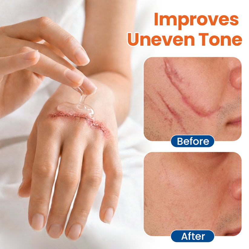 ⏳Limited-time 49% off⏰💥Timilk® DermalRebuild Skin Renewal Gel