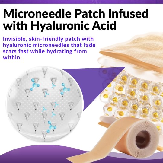 Official Store: LAOZIK™ Repair Microneedles Pro Patches with Hyaluronic Acid Nano-Heal Treatment for new and old scars, reduction of surgical scars, stretch marks, keloids, acne, burns, warts, dermatomas, and varicose veins