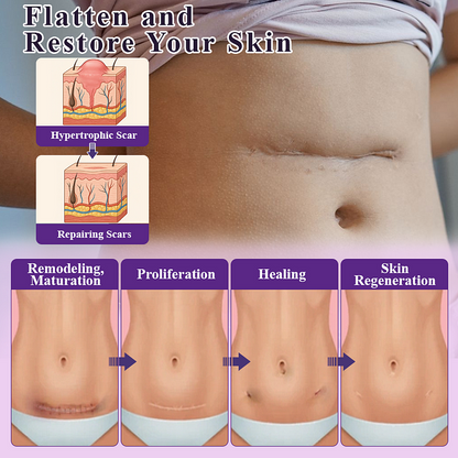 BQYOOM™ SiluSkin Advanced Face & Body Scar Gel🎉SPECIAL OFFER: 60% OFF This Today Only!🔥