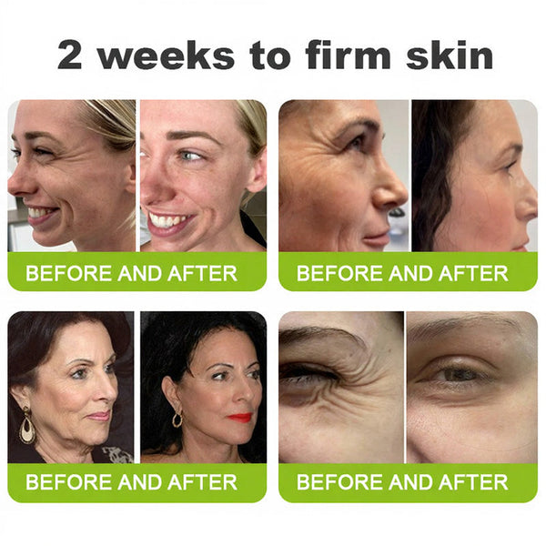 🧠👨‍⚕️Made and shipped from the USA 💫LOVILDS® Skin Tightening & Vita-A Retinol Retinol shot Anti-Wrinkle Firming Tightening cream - Last Day Promotion 50% OFF