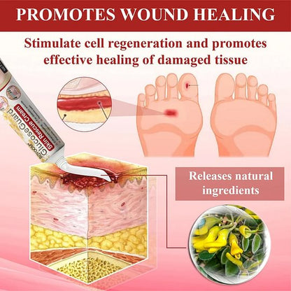 ⏰Last Day Promotion: 70% OFF 🔥BQYOOM™ GlucoseGuard Skin Rescue Cream