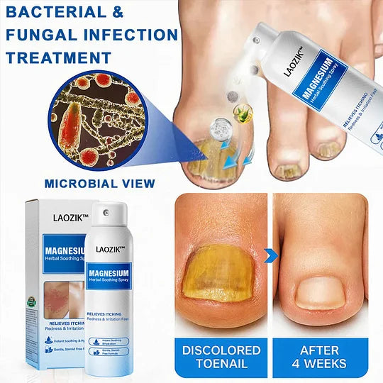 🔥Final 3 Hours: 80% OFF -LAOZIK™ Magnesium Herbal Soothing Spray
