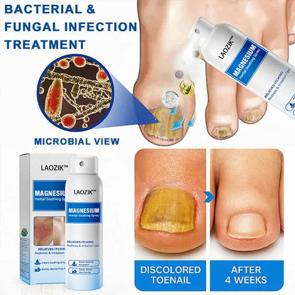 🔥Final 3 Hours: 80% OFF -LAOZIK™ Magnesium Herbal Soothing Spray