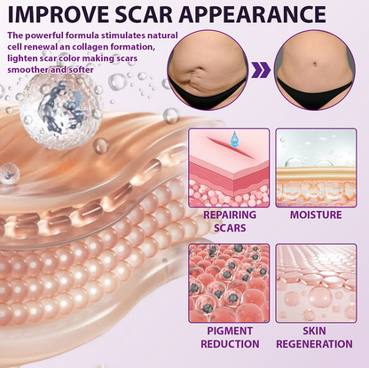 BQYOOM™ SiluSkin Advanced Face & Body Scar Gel🎉SPECIAL OFFER: 60% OFF This Today Only!🔥