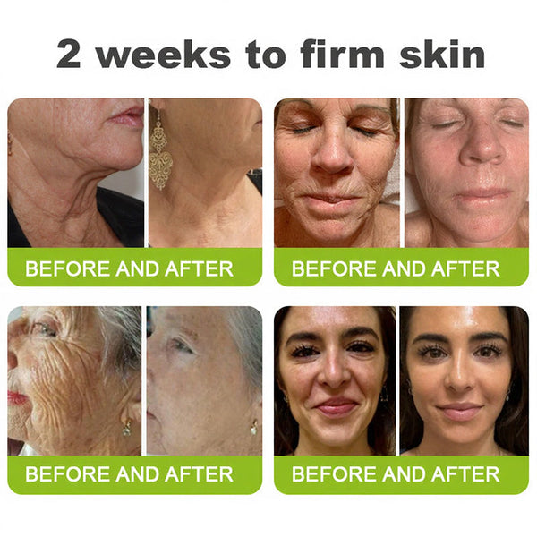🧠👨‍⚕️Made and shipped from the USA 💫LOVILDS® Skin Tightening & Vita-A Retinol Retinol shot Anti-Wrinkle Firming Tightening cream - Last Day Promotion 50% OFF