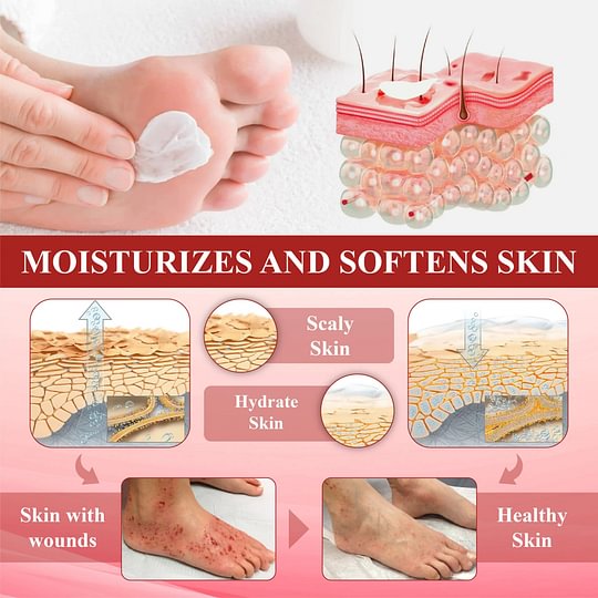 ⏰Last Day Promotion: 70% OFF 🔥BQYOOM™ GlucoseGuard Skin Rescue Cream