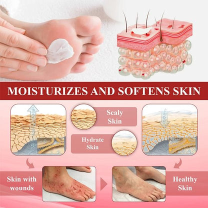 ⏰Last Day Promotion: 70% OFF 🔥BQYOOM™ GlucoseGuard Skin Rescue Cream