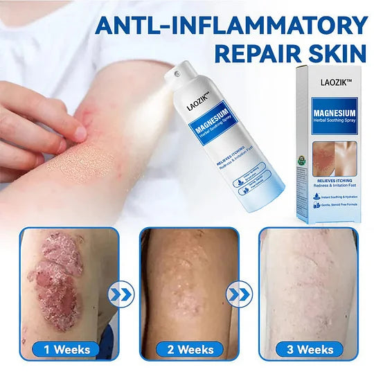 🔥Final 3 Hours: 80% OFF -LAOZIK™ Magnesium Herbal Soothing Spray