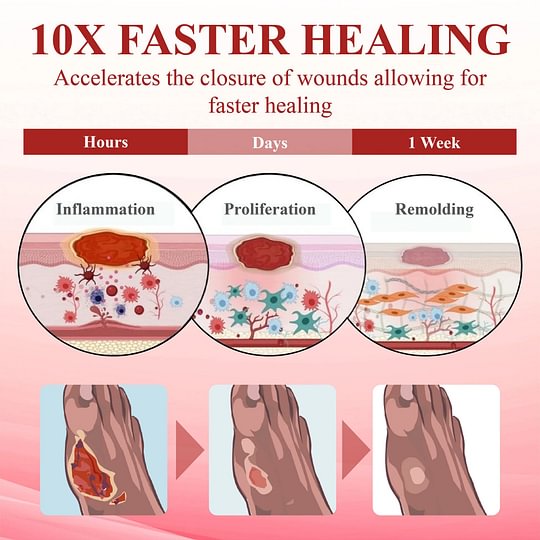 ⏰Last Day Promotion: 70% OFF 🔥BQYOOM™ GlucoseGuard Skin Rescue Cream