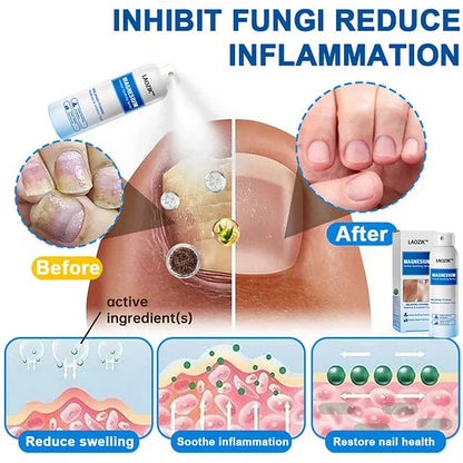 🔥Final 3 Hours: 80% OFF -LAOZIK™ Magnesium Herbal Soothing Spray