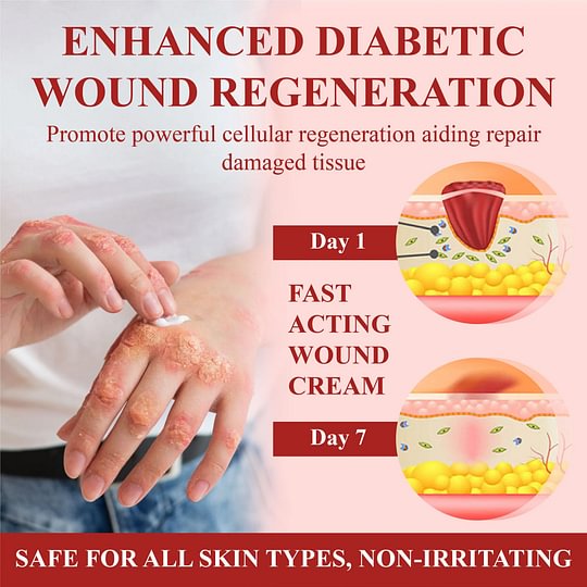 ⏰Last Day Promotion: 70% OFF 🔥BQYOOM™ GlucoseGuard Skin Rescue Cream