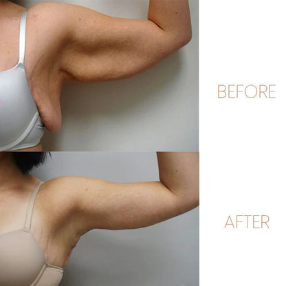 Lymphatic Drainage Therapeutic Magnetic Ring（Limited time discount 🔥 last day）