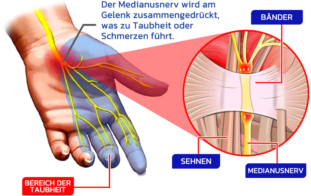 🎁 Sale 48% - GFOUK™ NumbFix Hand and Foot Spray