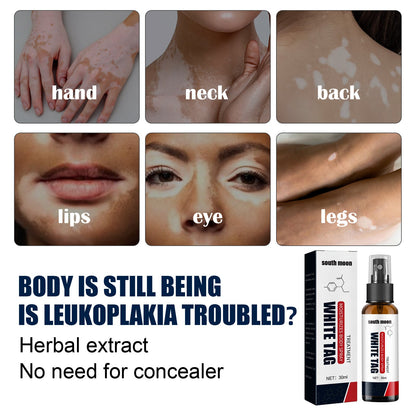 Vitiligo Relief Spray