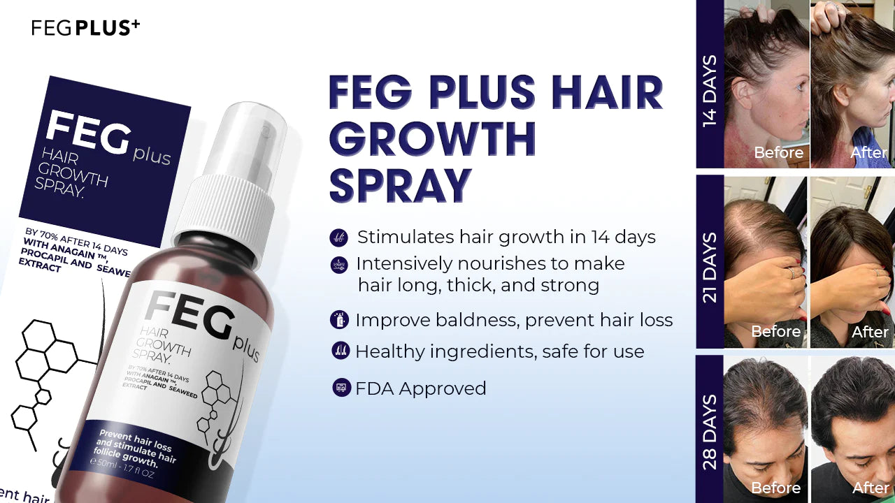 🔥LAST DAY Promotion 49% OFF🔥FEG Plus Hair Growth Spray