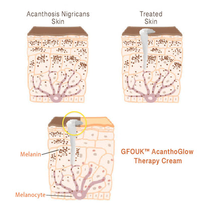 JAYSUING™ AcanthoGlow Therapy Cream