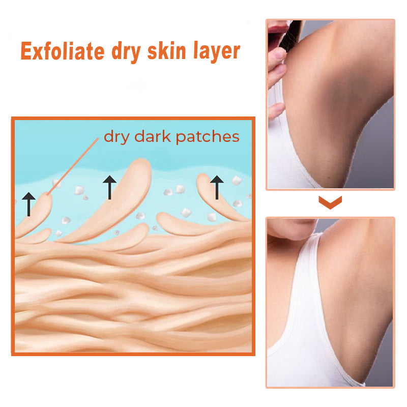 JAYSUING™ AcanthoGlow Therapy Cream