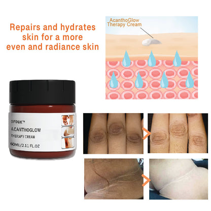 JAYSUING™ AcanthoGlow Therapy Cream