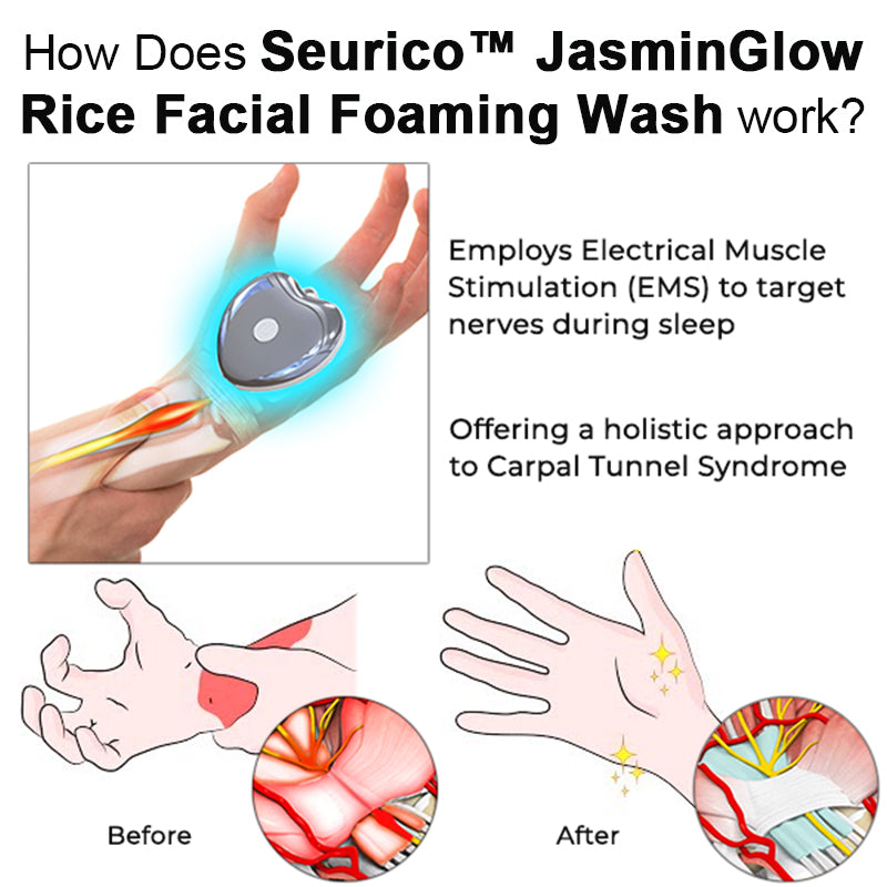 Seurico™ PROMAX NerveEase Carpal Tunnel Treatment Device