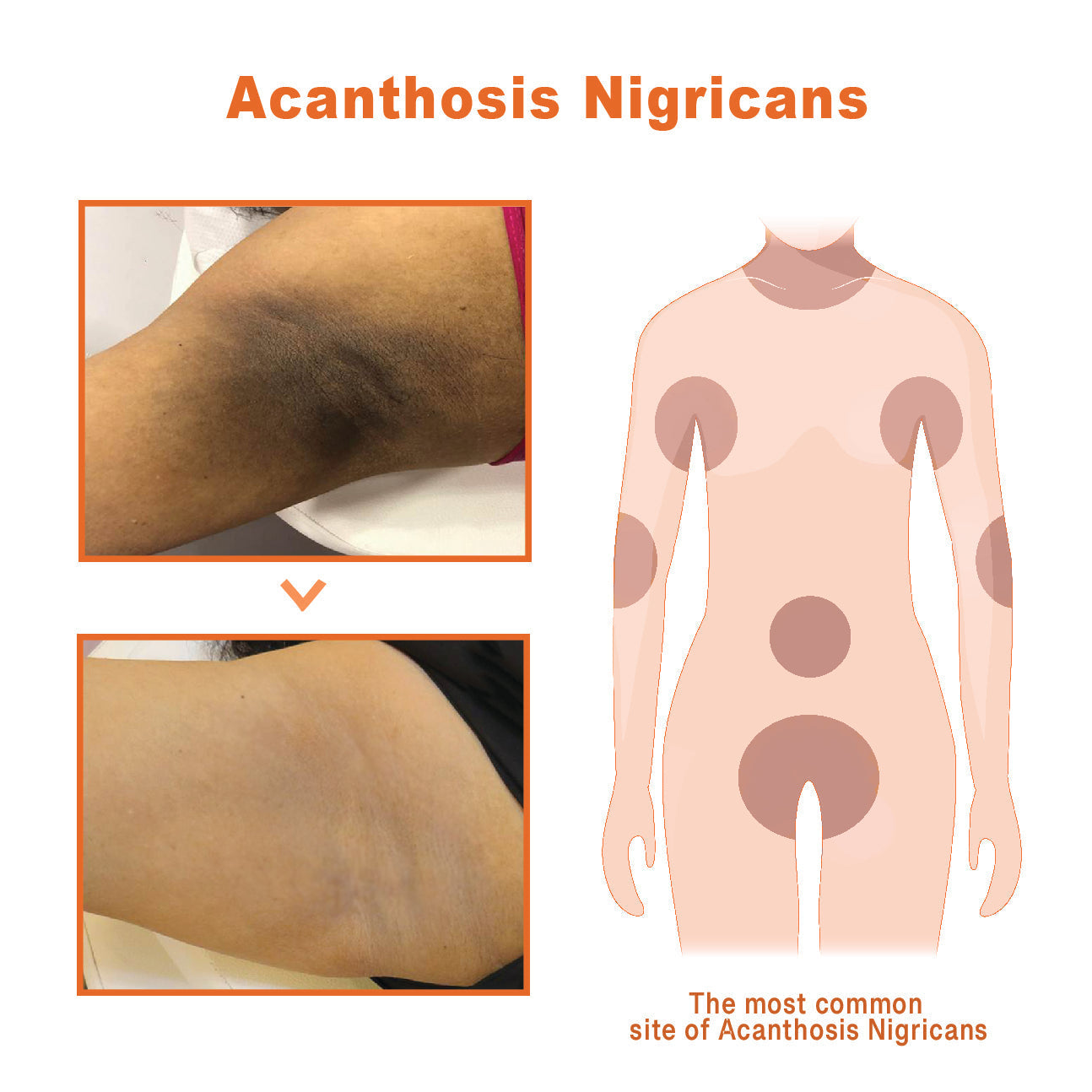 JAYSUING™ AcanthoGlow Therapy Cream