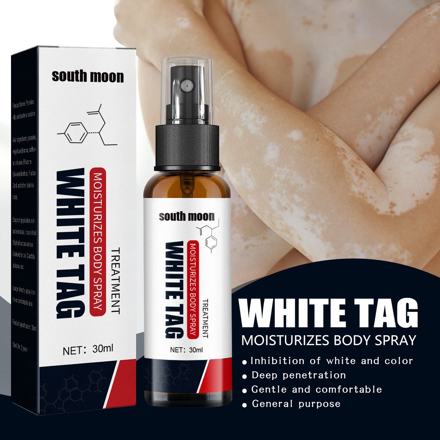 South Moon™ Vitiligo Relief Spray