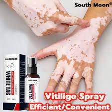 Vitiligo repair spray